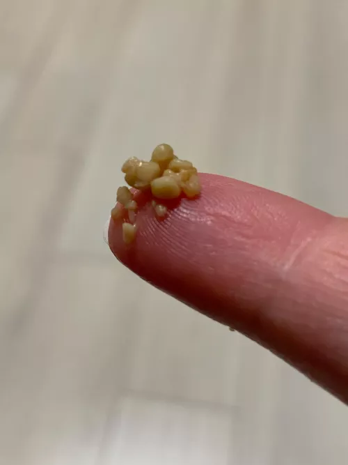 It just kept going and frankly, I’m a bit disgusted with myself.