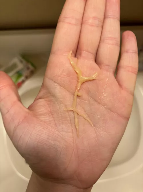 Lil’ bronchial caste