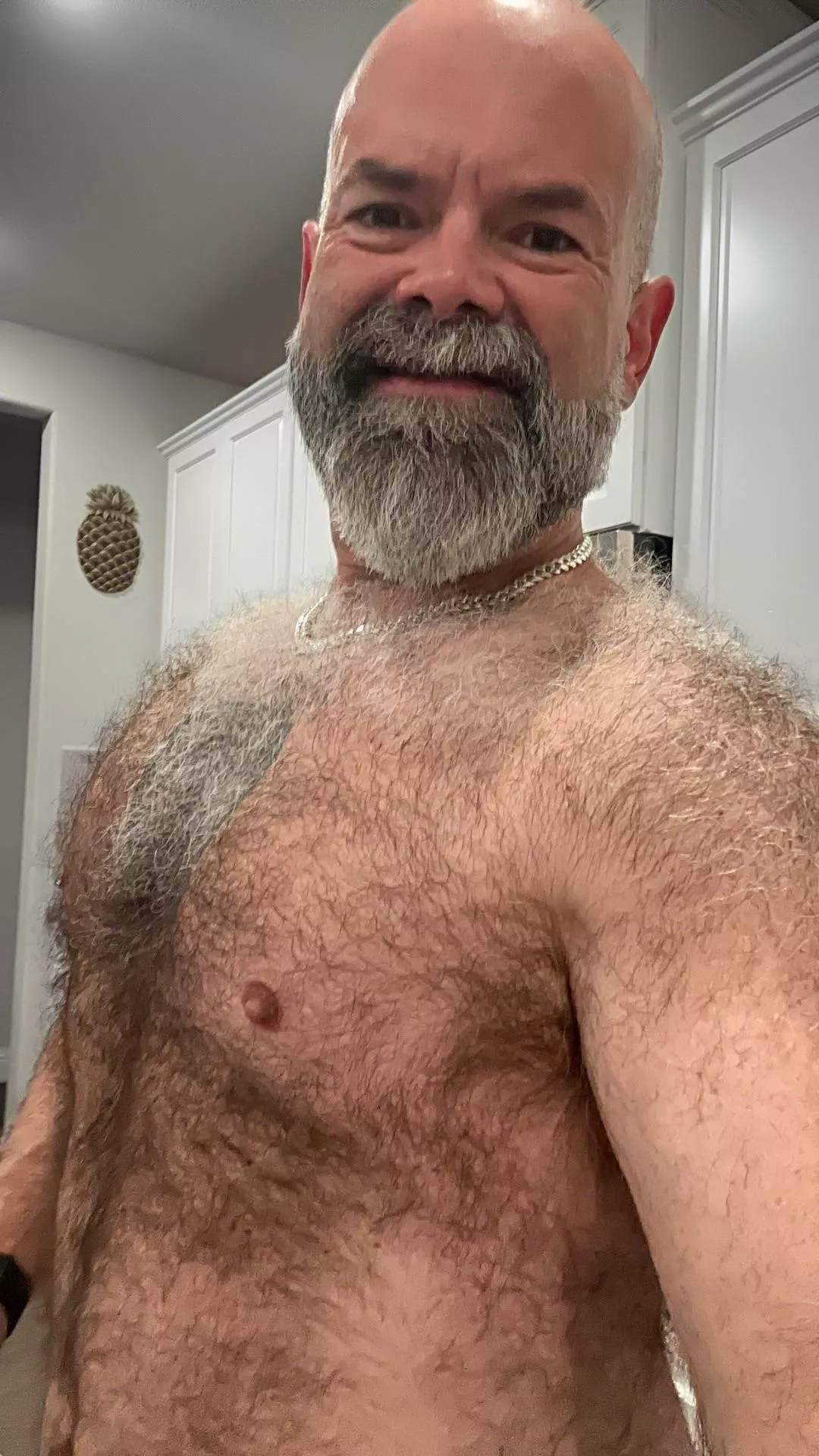 Am I insanely hairy?