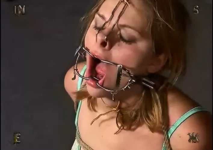 Dental gag (insex)