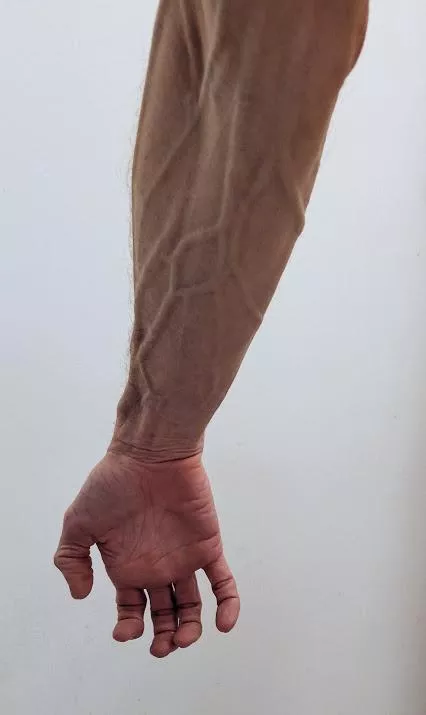 Did I post this in vein?