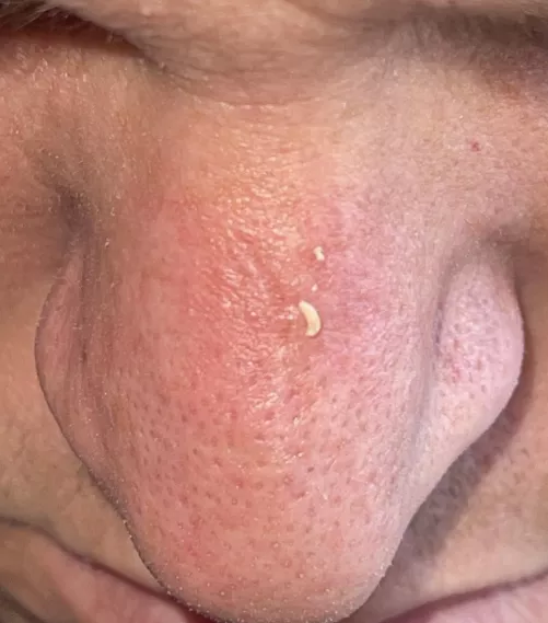 My husband’s nose is a gold mine