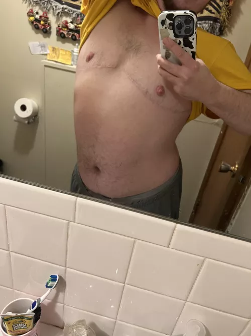 26, trans guy here ☺️