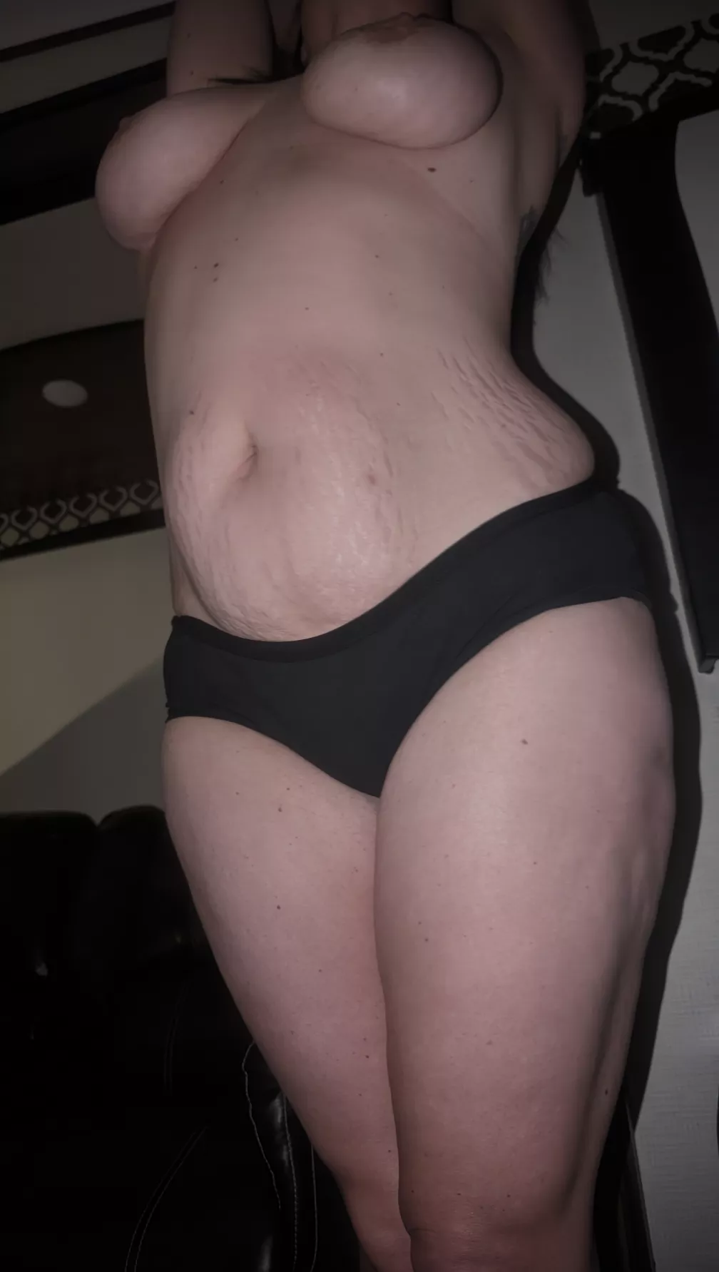 I hope you don't mind a few tiger stripes and hail dents on my mommy body, my husbands friends don't 