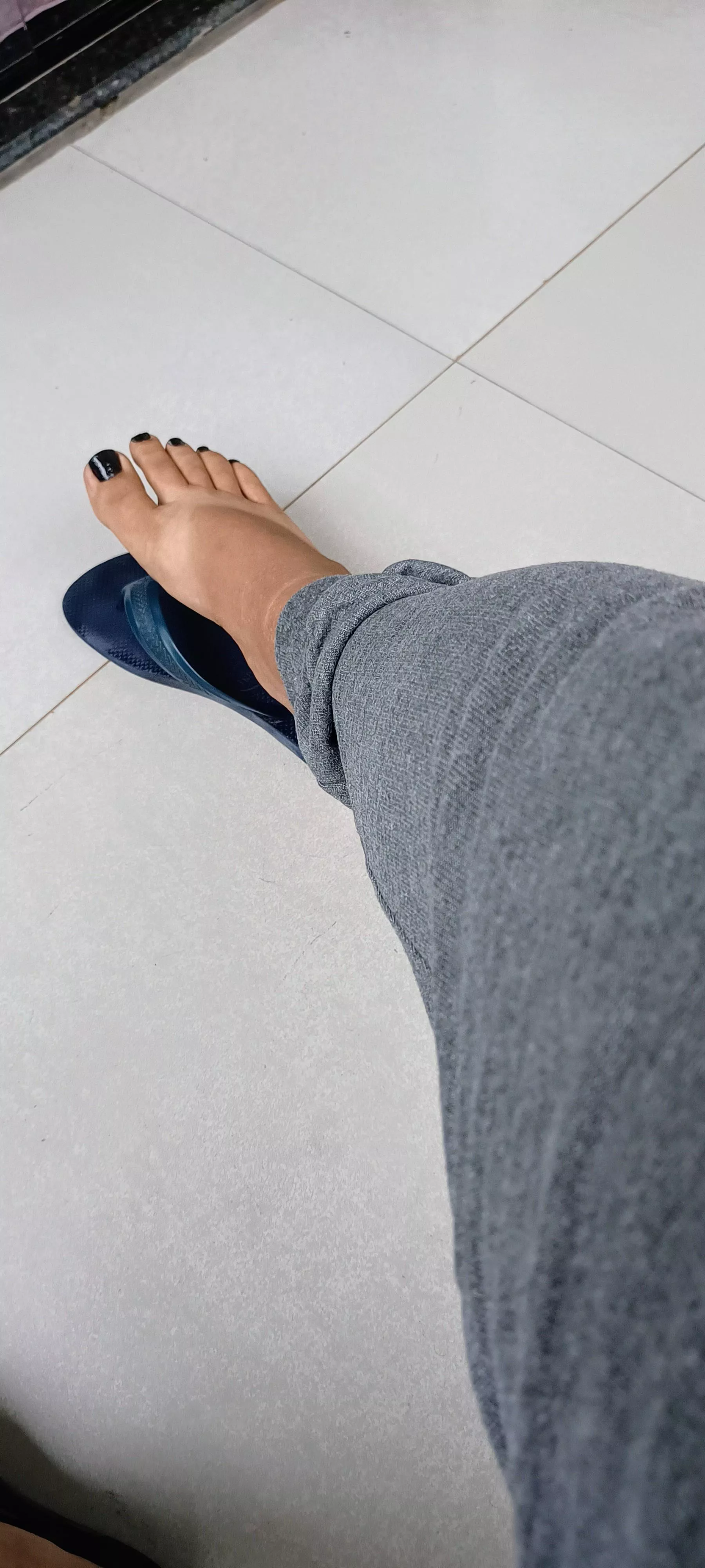 My flip-flops are leaving a mark on my feet