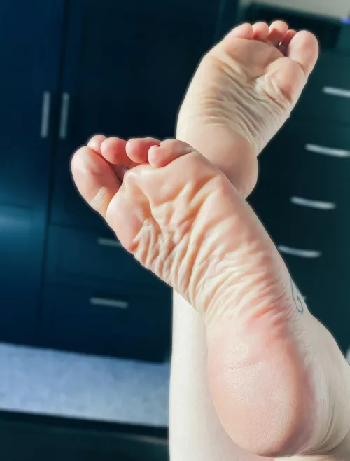 Are these wrinkles distracting?