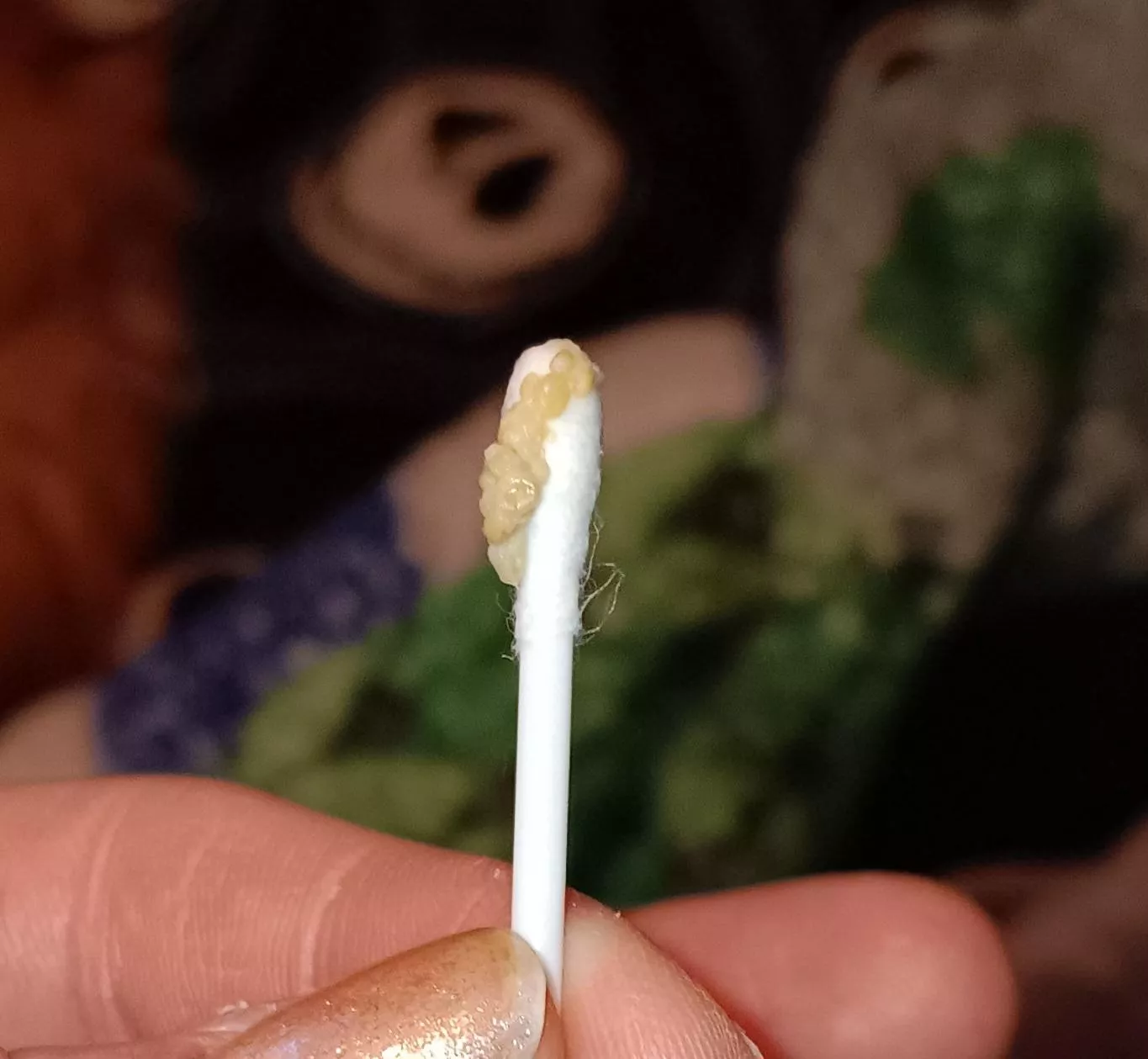 Tonsil puss from strep throat 