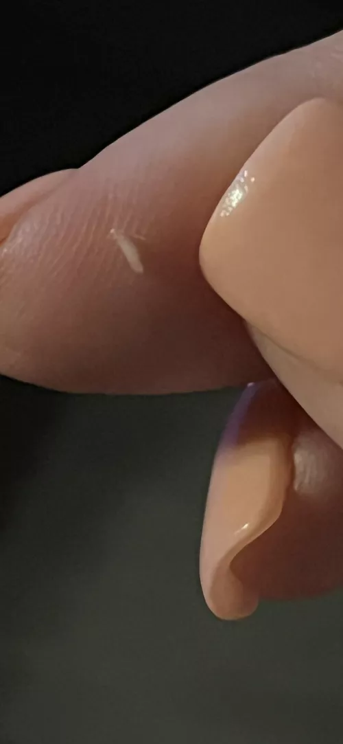 Weird plug I pulled out of the middle of a cyst on the inside of my thigh.