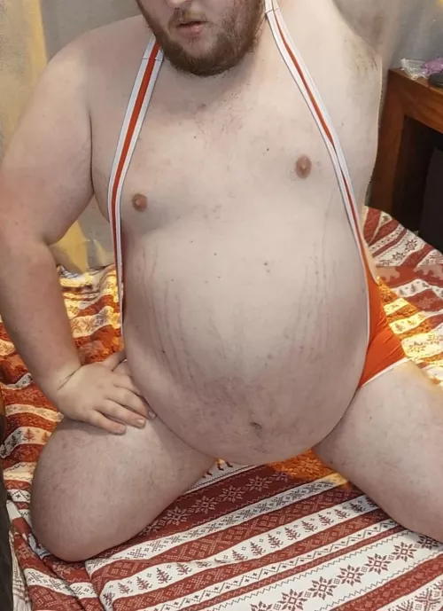 Are stretchmarks unattractive ? 