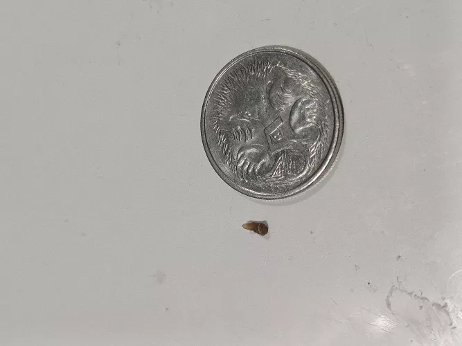 I Just pulled out this big blackhead from my upper back. 5c coin for scale. 