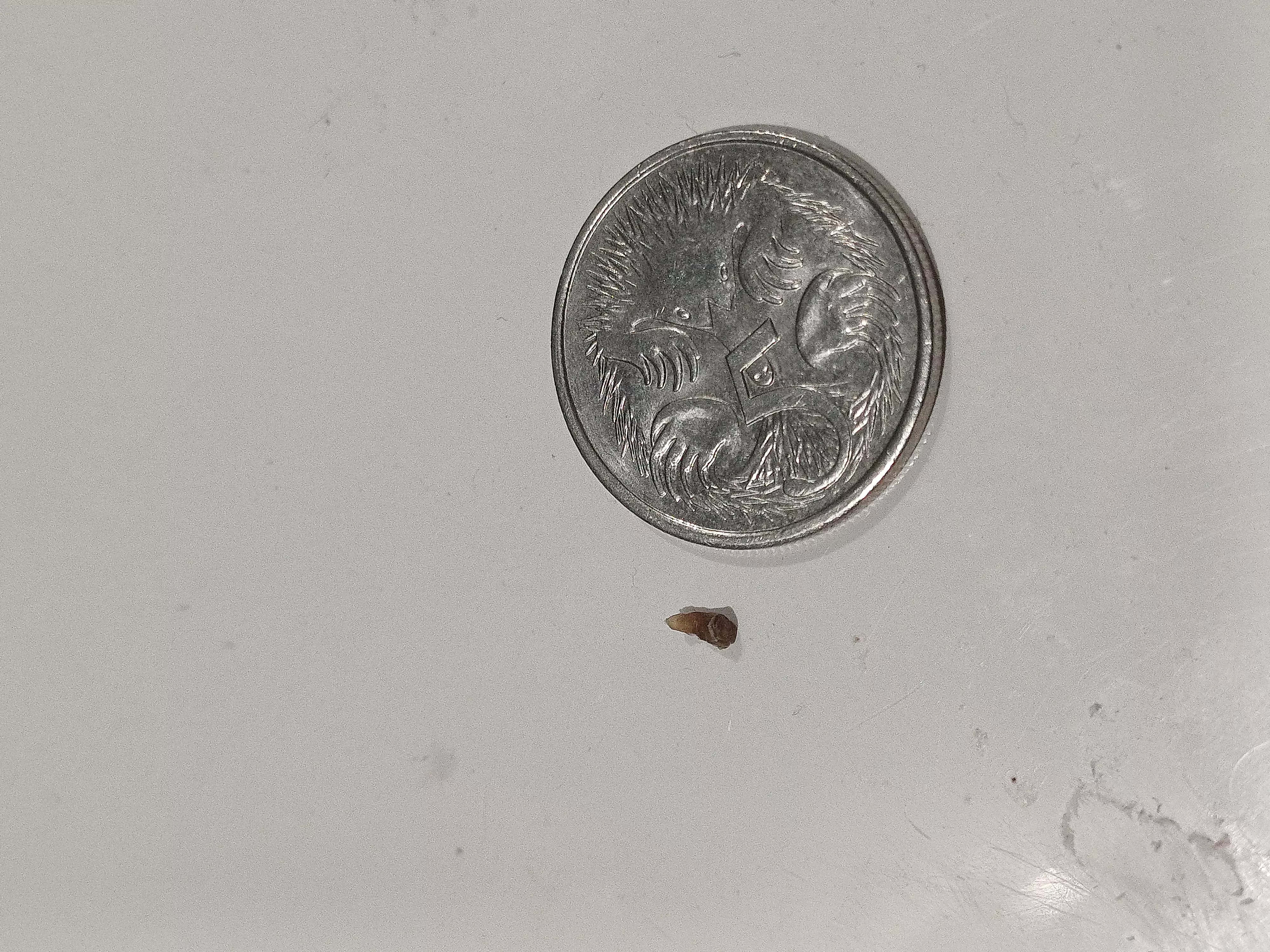 I Just pulled out this big blackhead from my upper back. 5c coin for scale. 