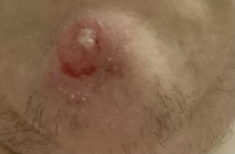 I want to pop it so bad