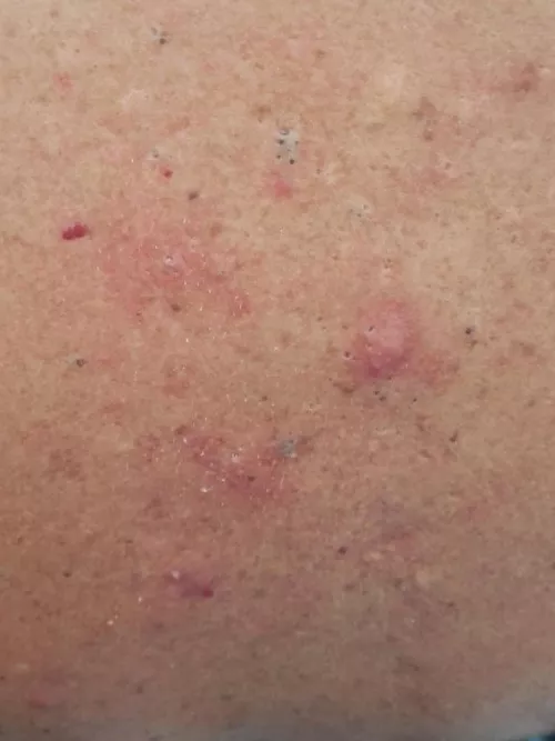 The back of a family friend