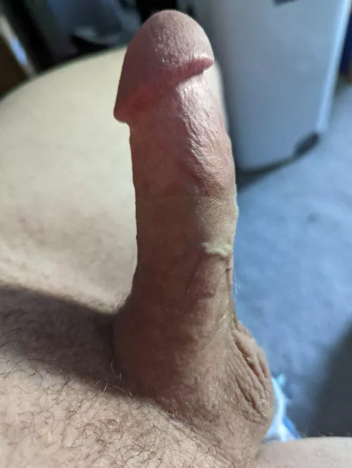 At least I have one good vein. Thoughts?