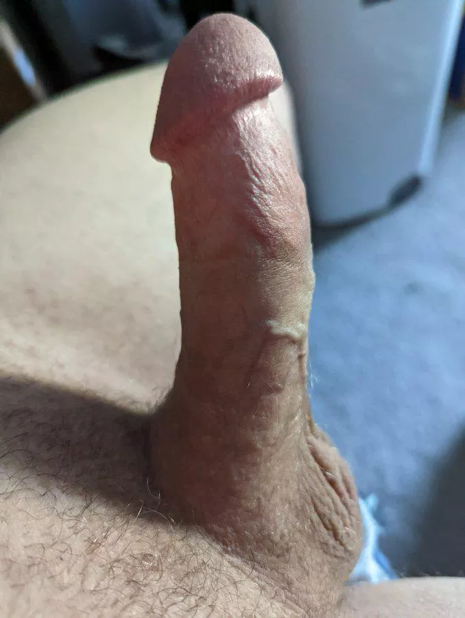At least I have one good vein. Thoughts?