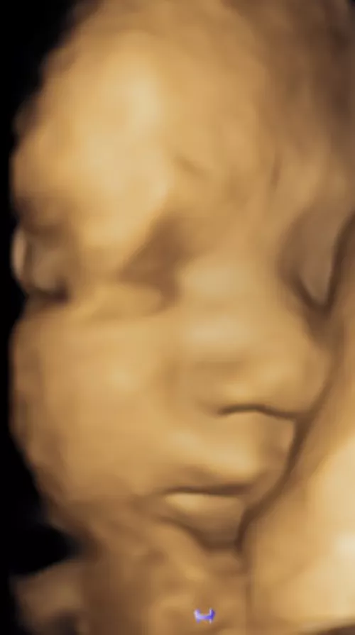 [OC] Update from the couple I helped conceive 