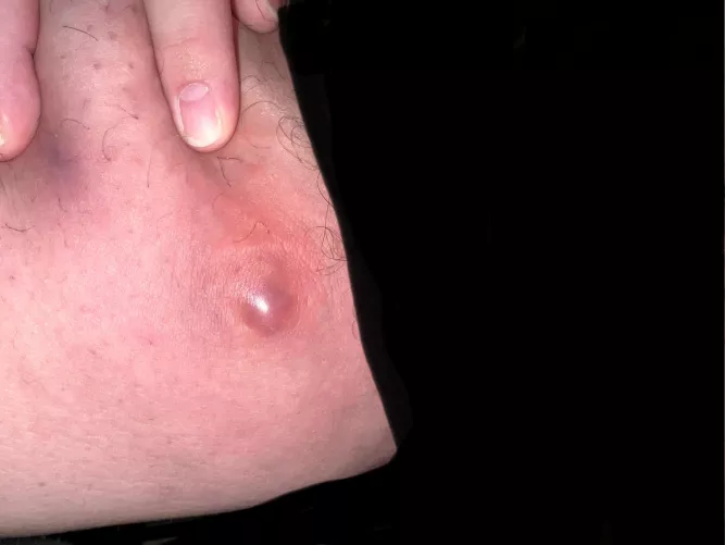 Just fucking pop already