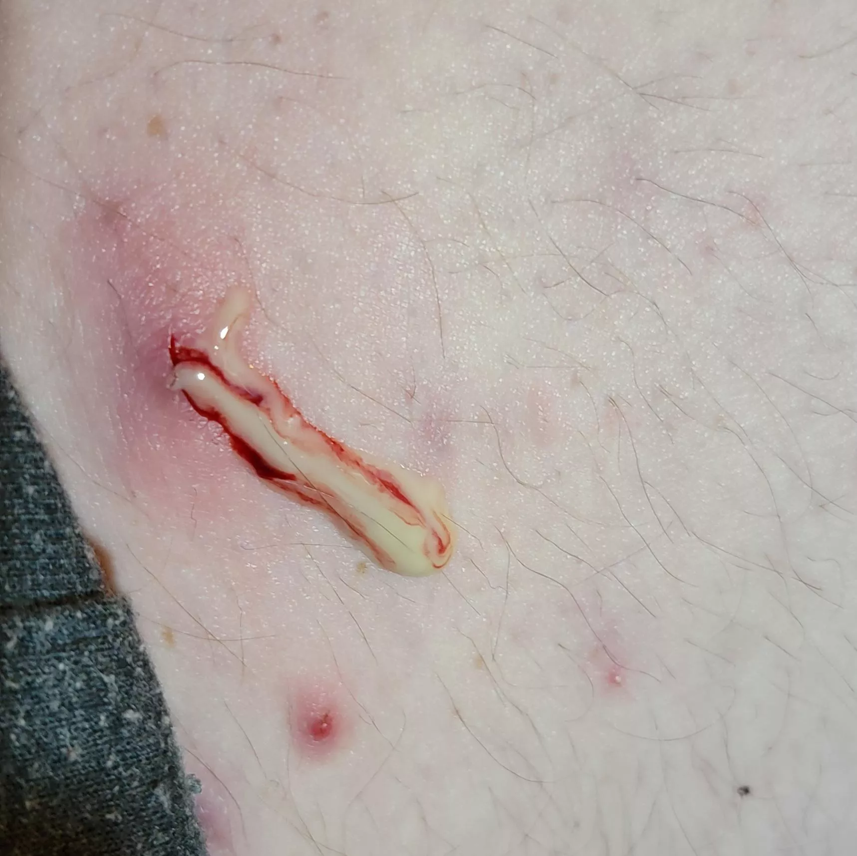 This. F##king. Hurt....