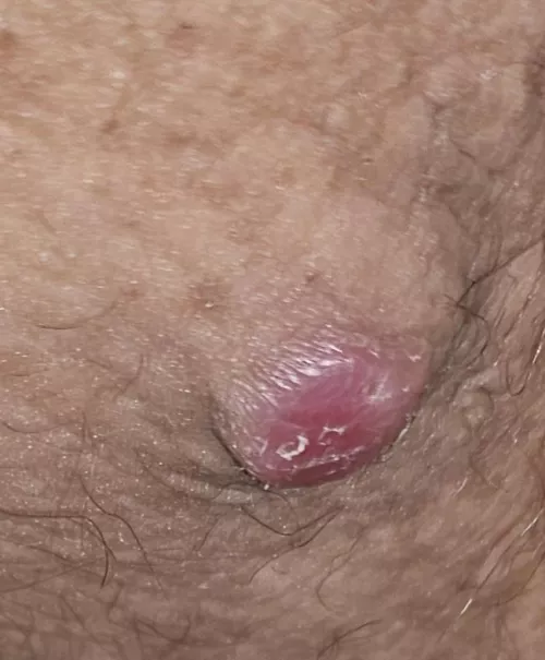 Big boi that i am scared to pop