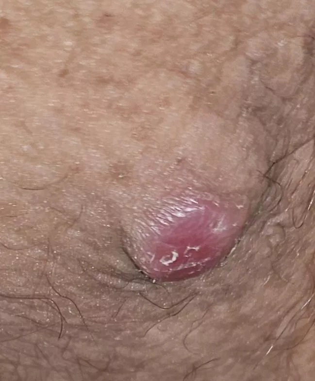 Big boi that i am scared to pop