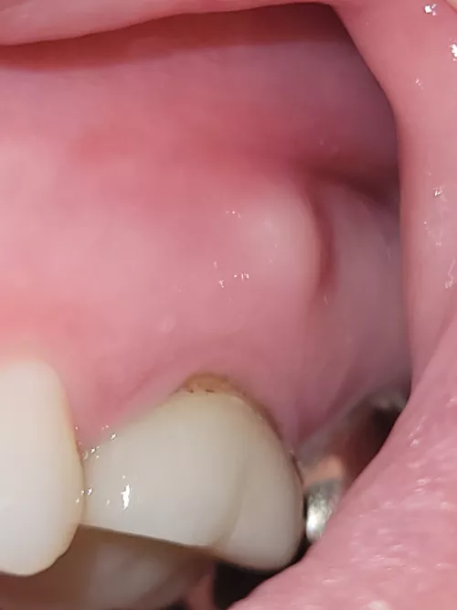 The Forbidden Gum Pop