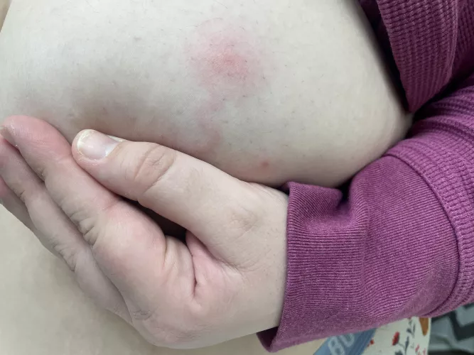 Unfortunate and now forbidden boob pop
