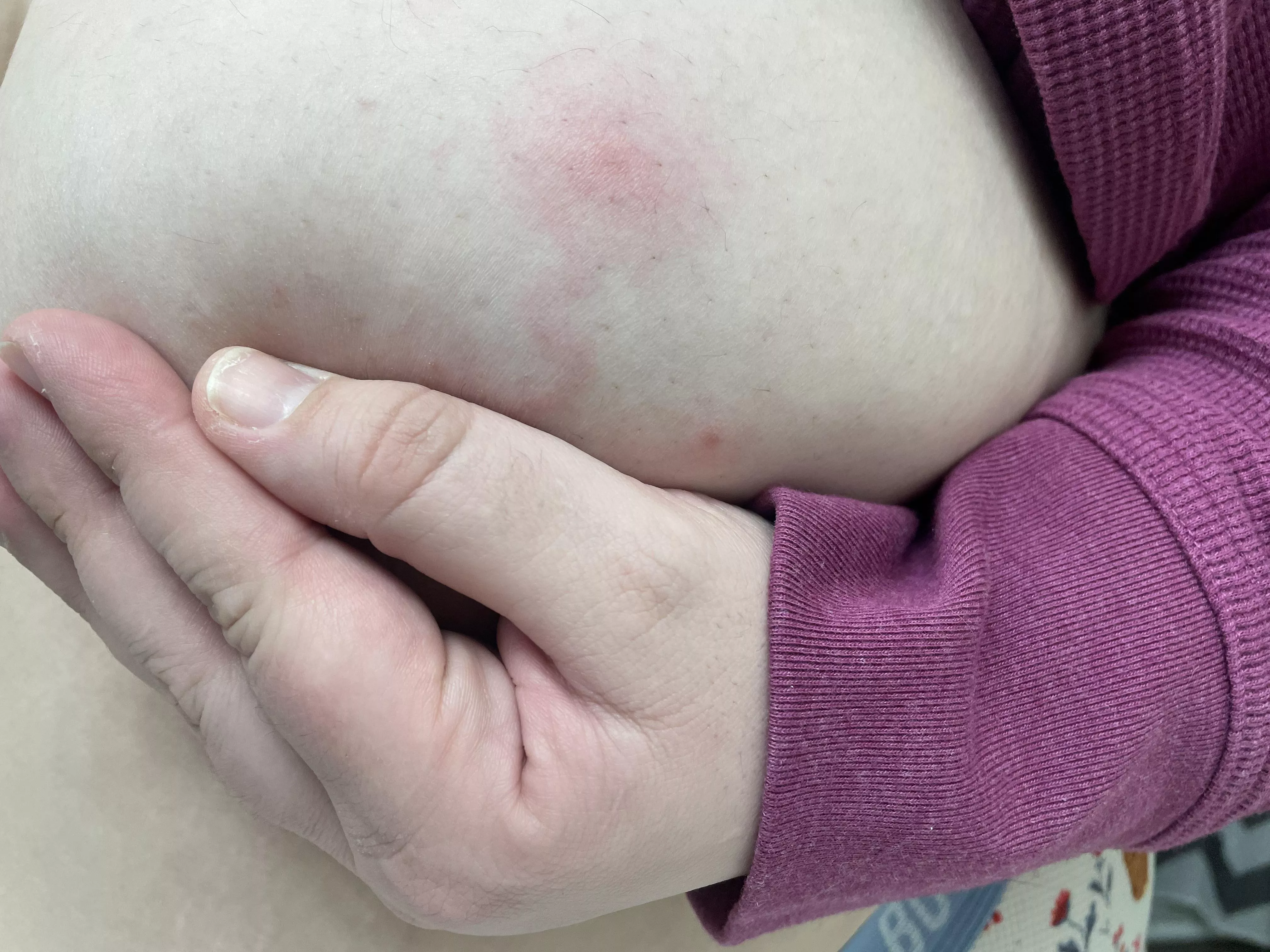 Unfortunate and now forbidden boob pop