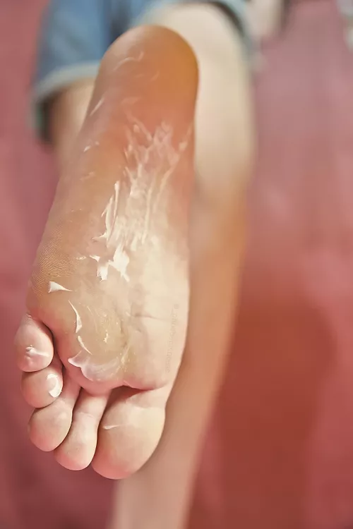 Will You Help Me Rub This In?