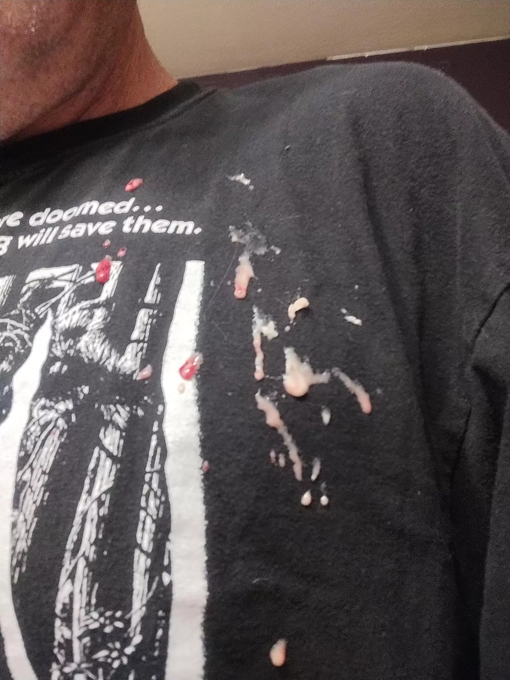 Abscess aftermath (earlobe)