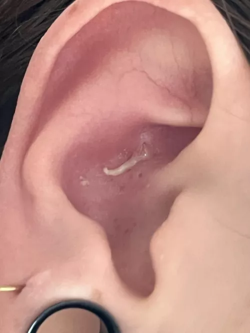 Had a super annoying pimple in my ear for like 3 days, I was messing with it and it finally popped, it was insane lmao. I wish I had filmed it 😩 I had no idea it was gonna give me this incredible pop 😭