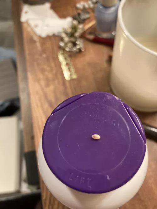 This thing just popped out of my thigh???