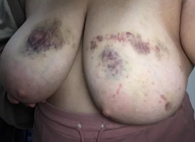 Do you wish it was worse?