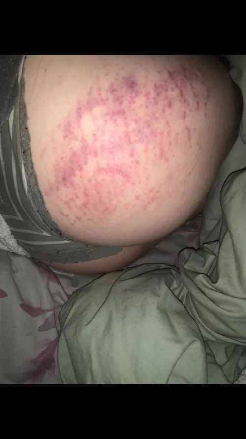 24 hours later, love the colour 😌