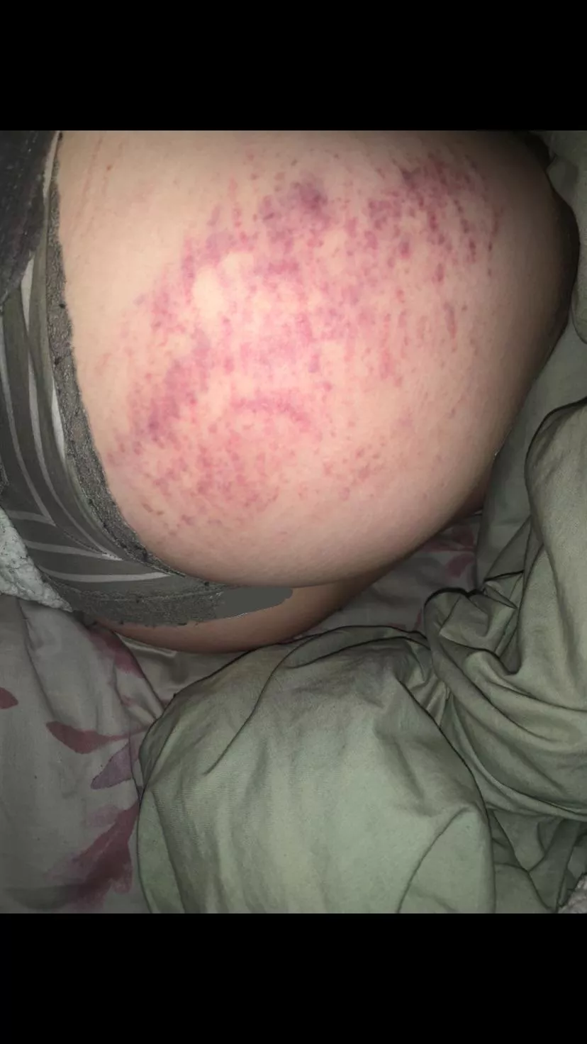 24 hours later, love the colour 😌