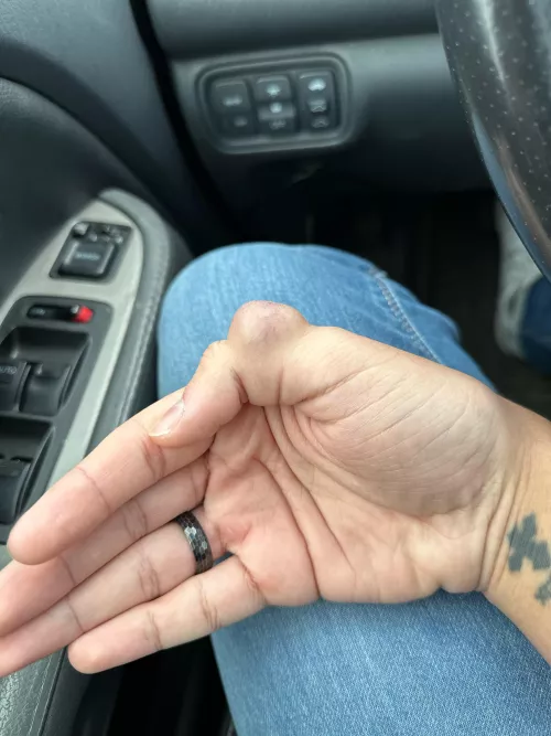 Meet Steve. He’s 8 years old.