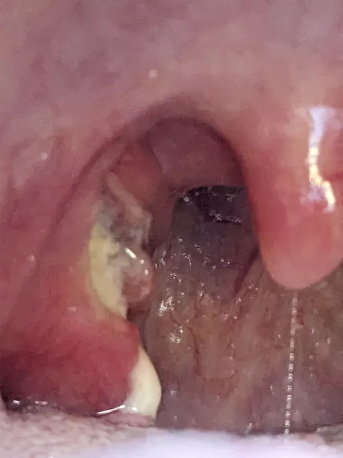 The day after suspected Quincy...