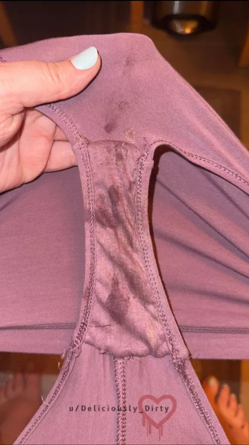 48h Update: I could smell them before I even took them off