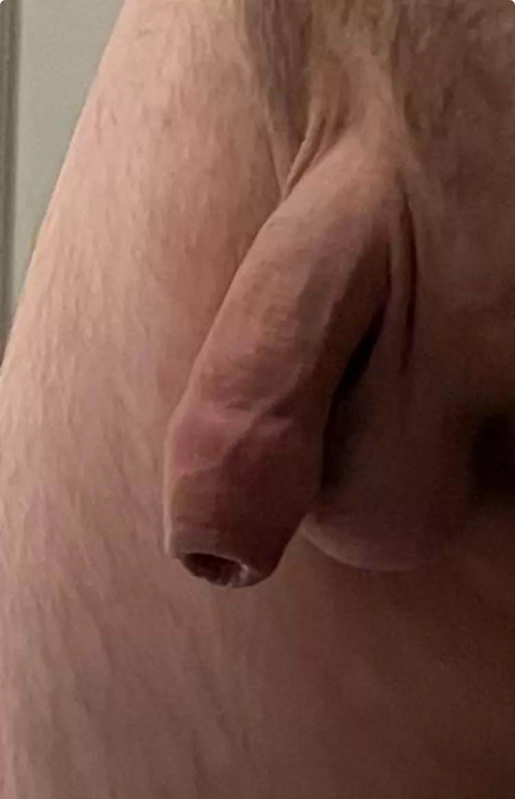 Foreskin Friday!