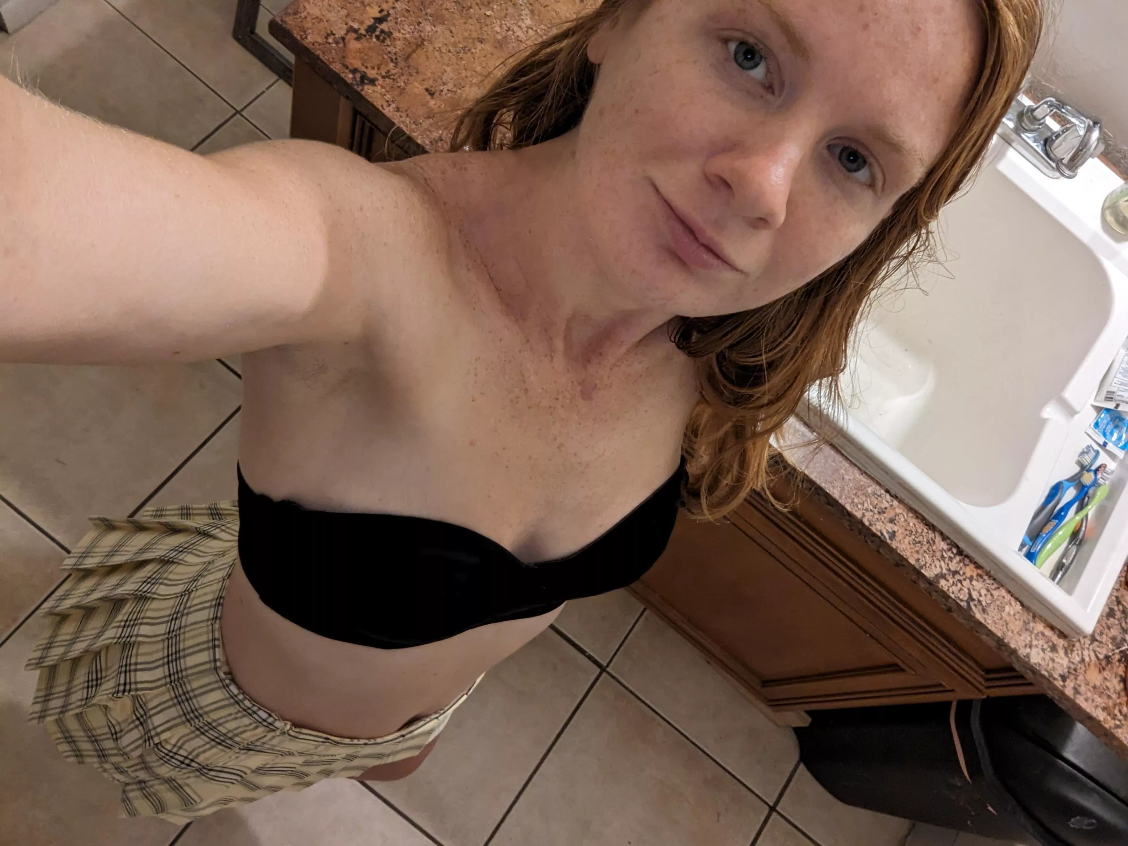 Freckle-infused fireball