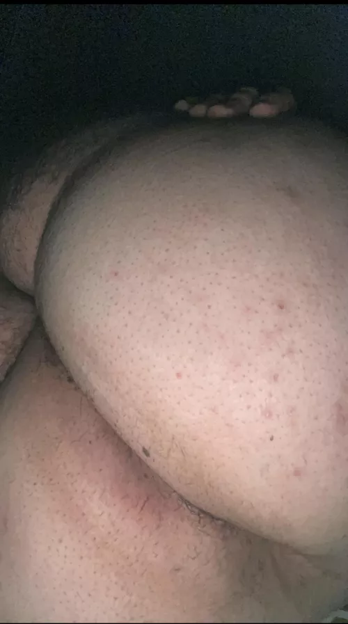 [18] Dropbox with all my nudes in my bio