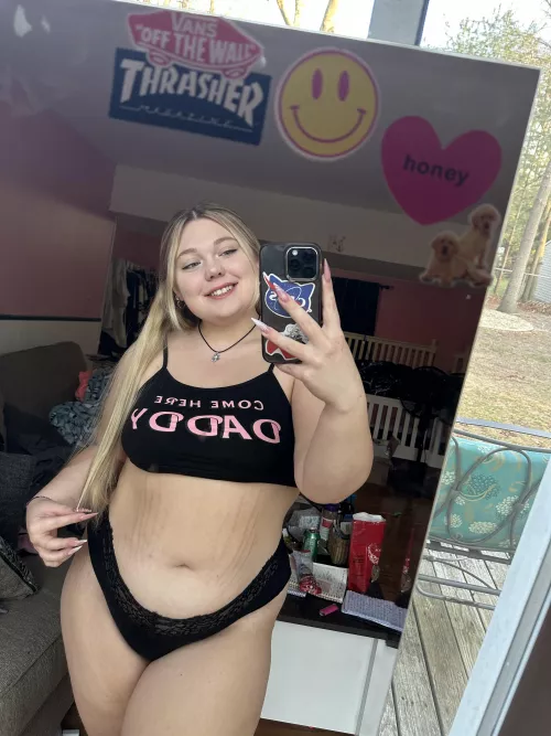 How do you feel about stretch marks 