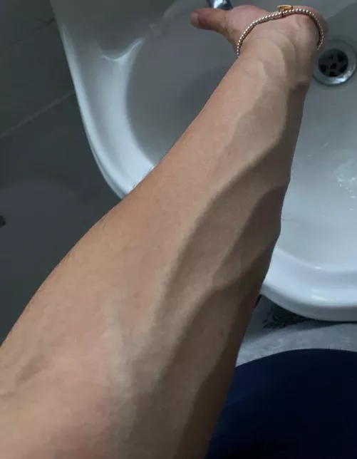 Veins Coming To Play