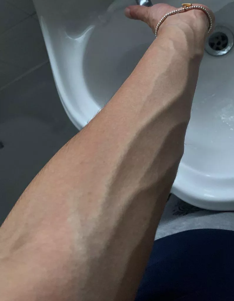 Veins Coming To Play