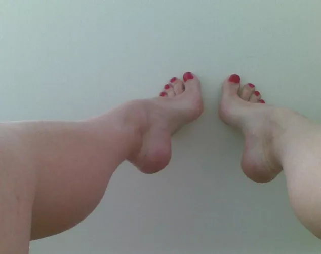 Red toes legs up