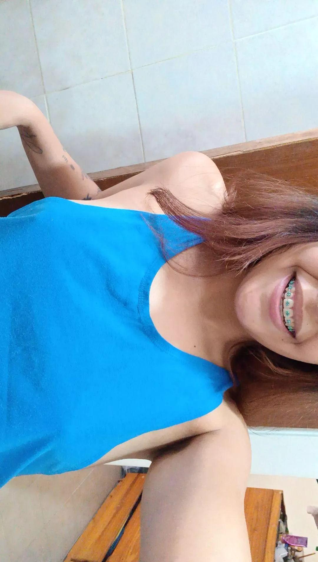 My braces want to get your attention, but you're seeing something else 