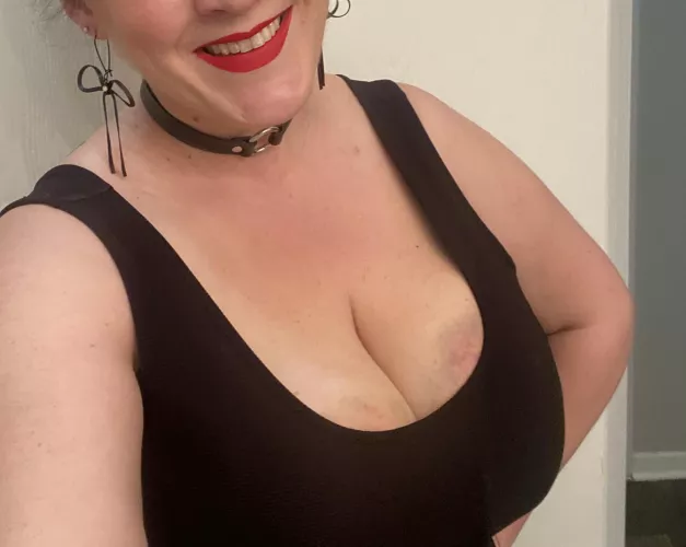 I love showing off my bruises!