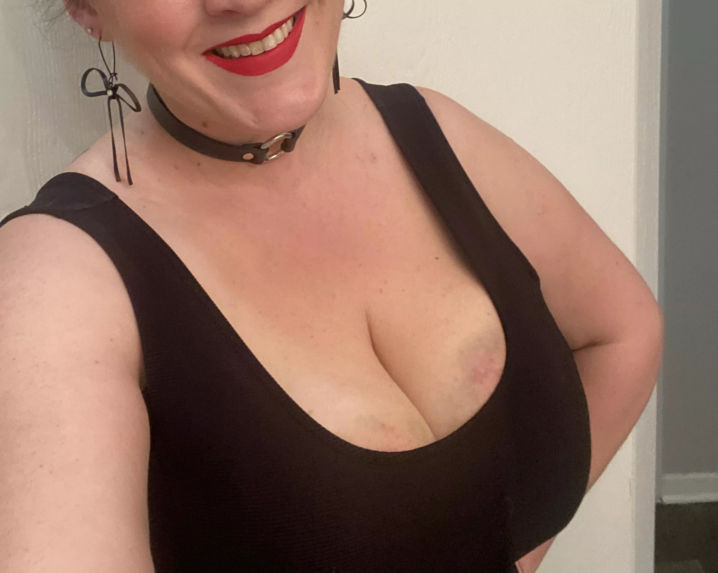 I love showing off my bruises!