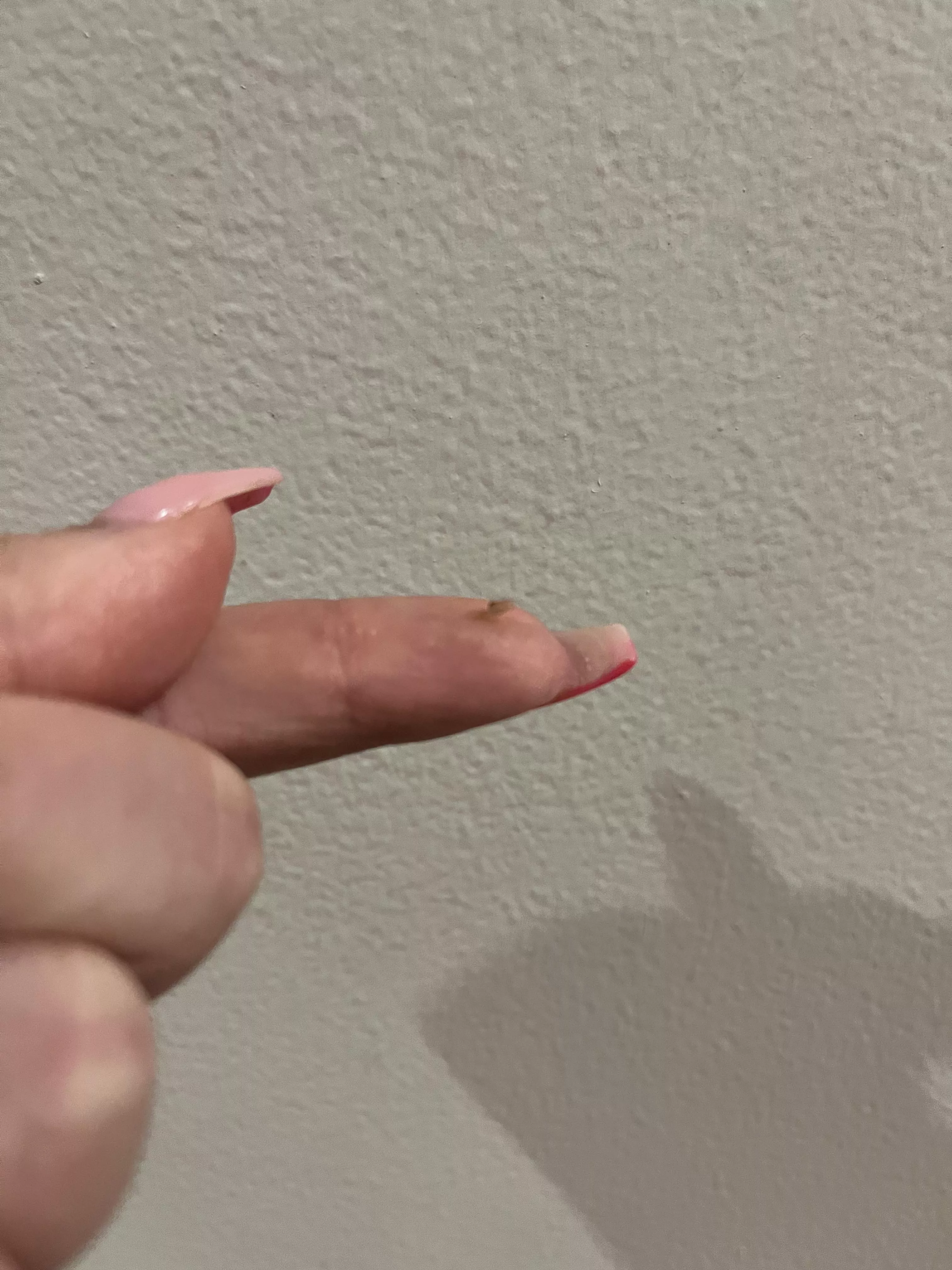 Finally got this sucker out of my scalp 