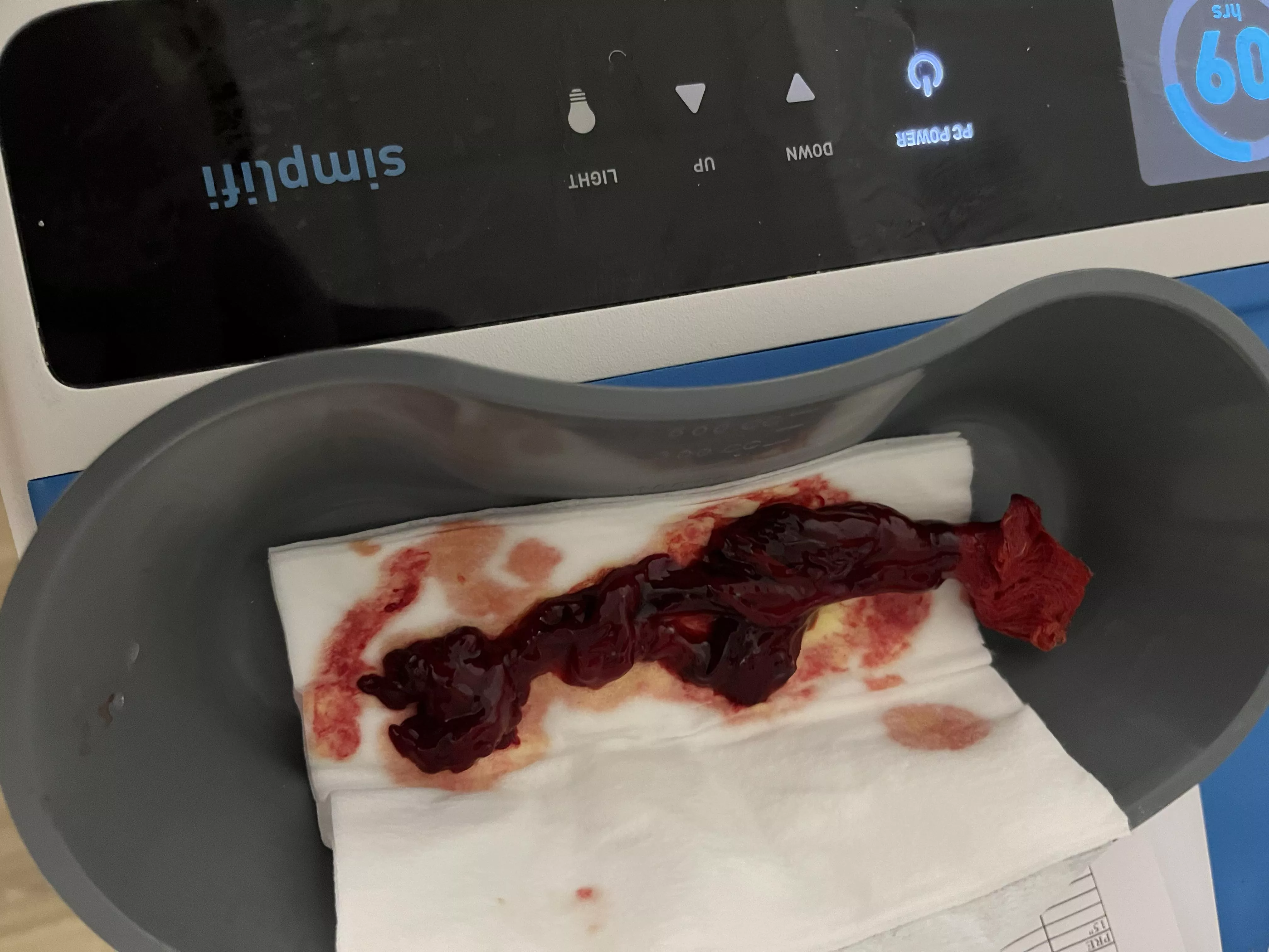 Nosebleed clot. Not for the squeamish.