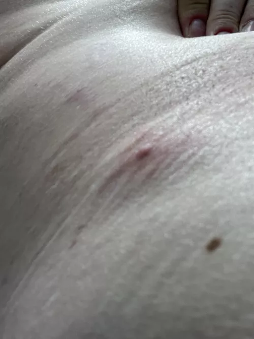 waistband monster is starting to show it's head. I wish these weren't so deep. it'd be nice to pop it and get it over with.